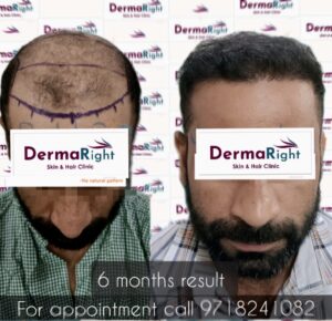 9df58095 7ffe 4797 8471 3acc6f25789a