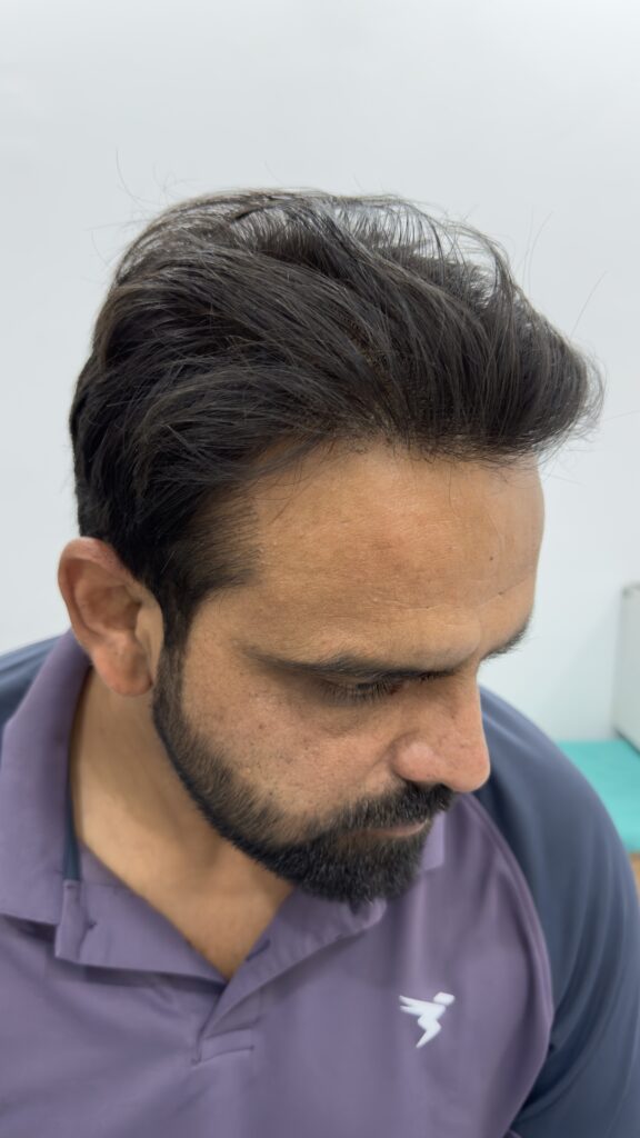 sonu after .jpg