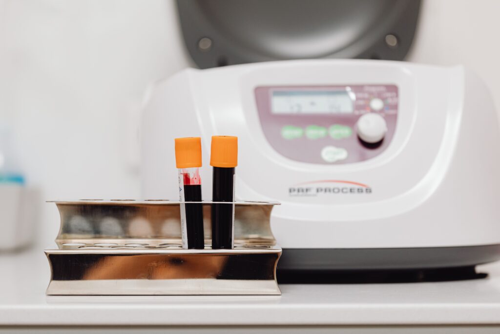 pexels photo 6627697 6627697 Blood samples in a rack with centrifuge in a laboratory environment.